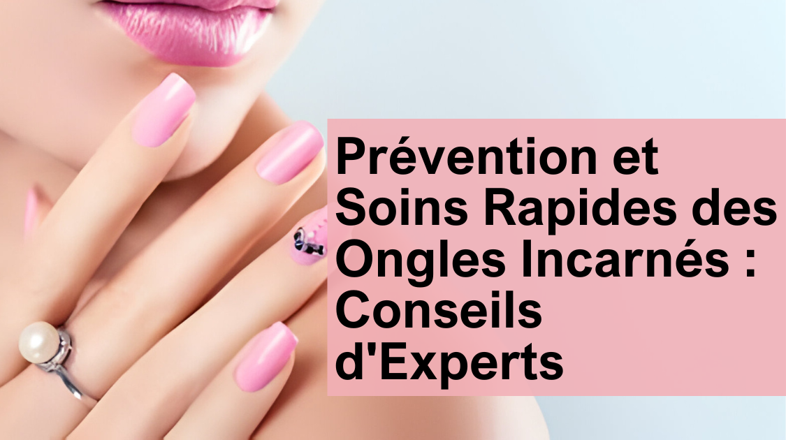 Prévention et Soins Rapides des Ongles Incarnés : Conseils d'Experts