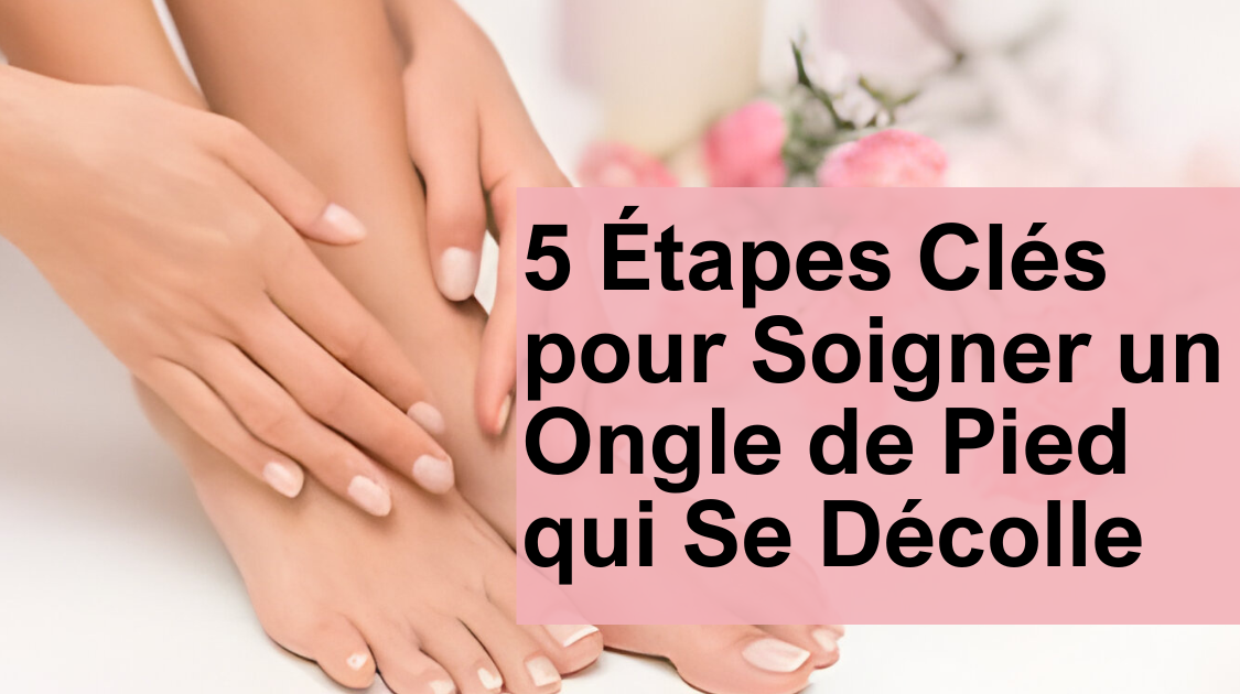 5 Étapes Clés pour Soigner un Ongle de Pied qui Se Décolle