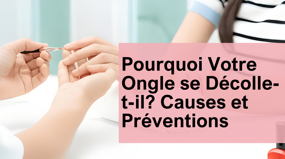 Pourquoi Votre Ongle se Décolle-t-il? Causes et Préventions